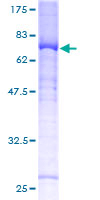 12.5% SDS-PAGE Stained with Coomassie Blue.